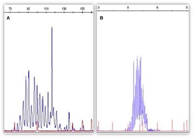 The Minimal Residual Disease in Non-Hodgkin's Lymphomas: From the Laboratory to the Clinical Practice